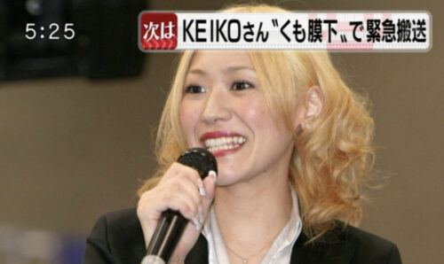KEIKOと小室哲哉の離婚